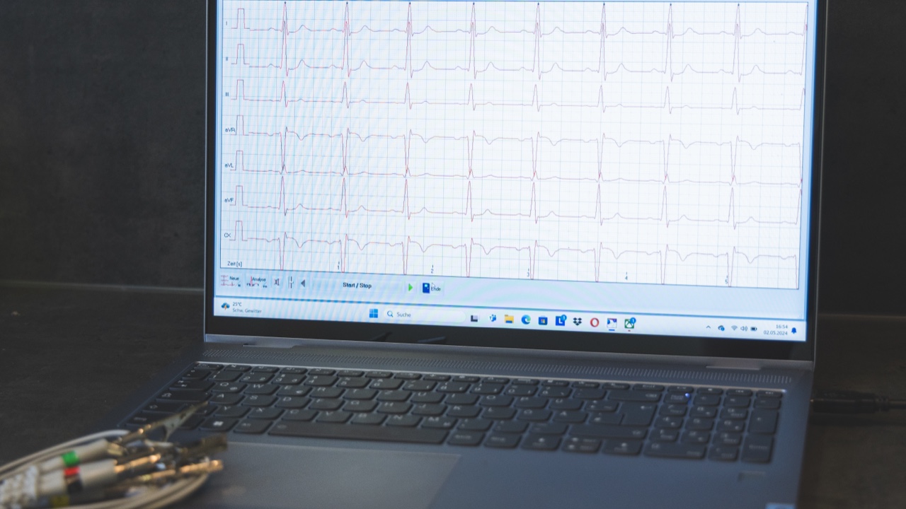 EKG wird auf Laptop angezeigt